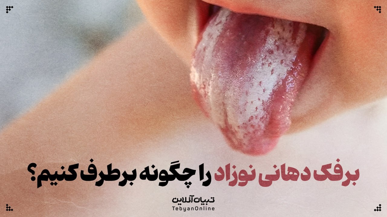برفک دهانی نوزاد را چگونه برطرف کنیم؟