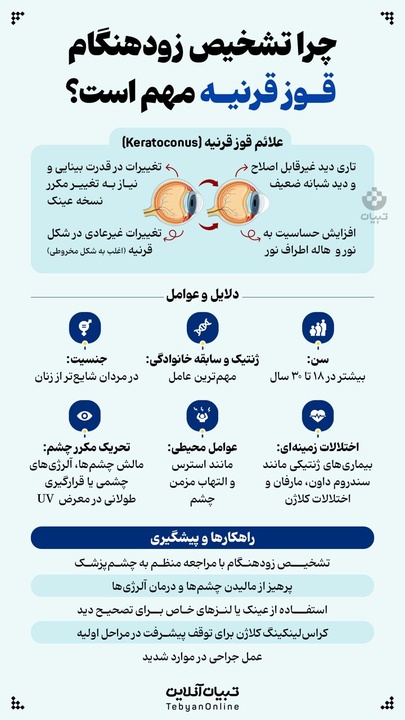 چرا تشخیص زودهنگام قوز قرنیه مهم است؟