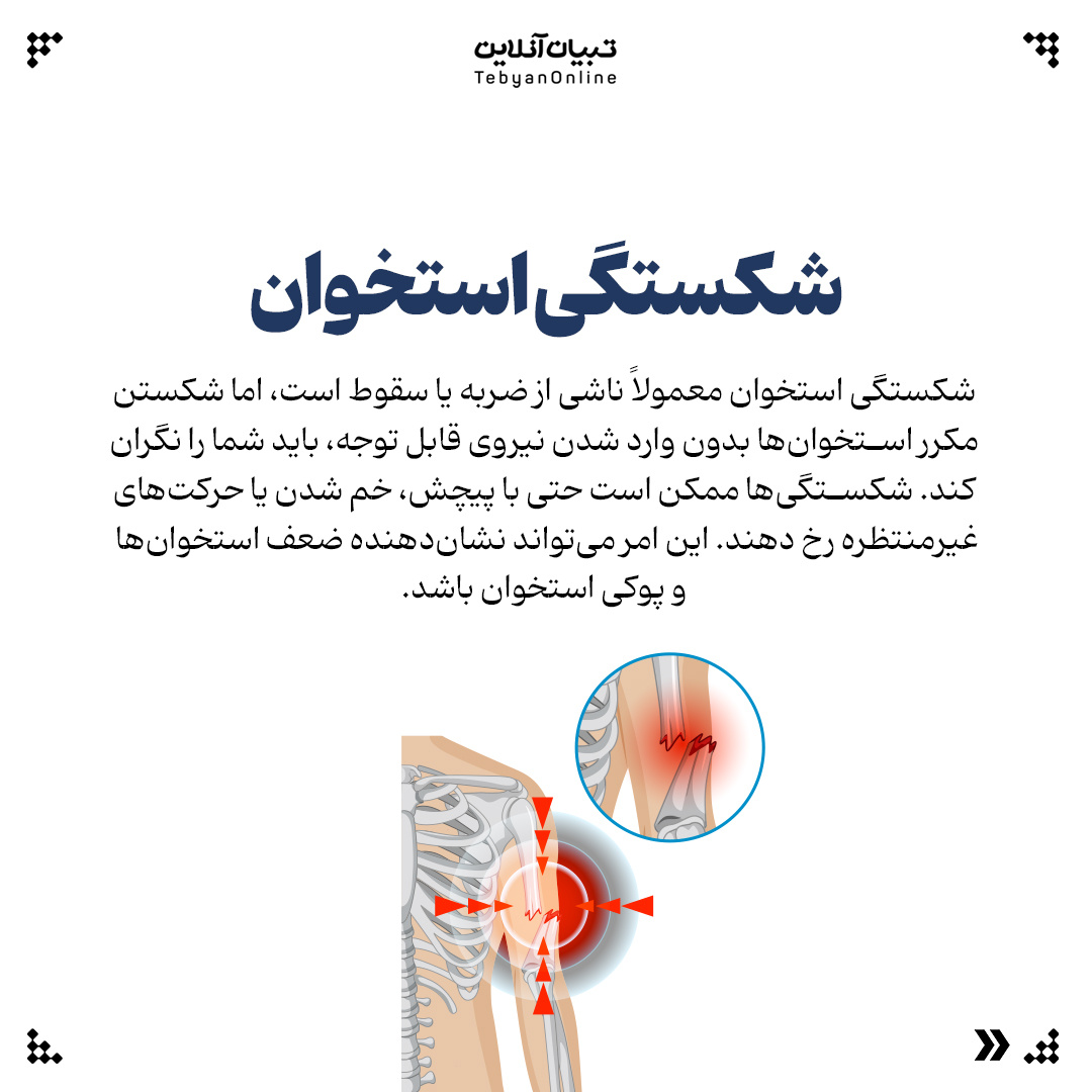 ۵ علامتی که شاید ندانید نشانه پوکی استخوان است