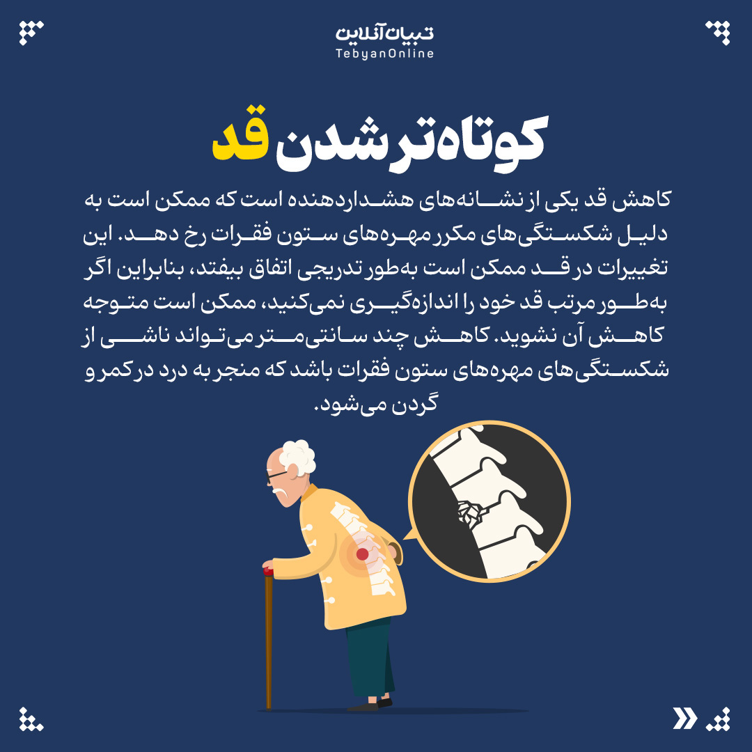 ۵ علامتی که شاید ندانید نشانه پوکی استخوان است