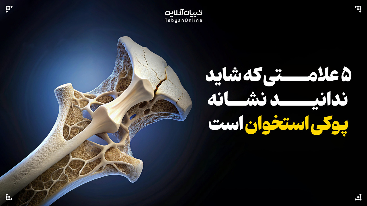 ۵ علامتی که شاید ندانید نشانه پوکی استخوان است
