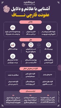 آشنایی با علائم و دلایل عفونت قارچی ناف