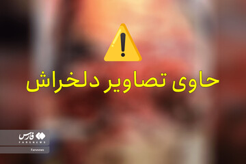 تصاویر دردناک