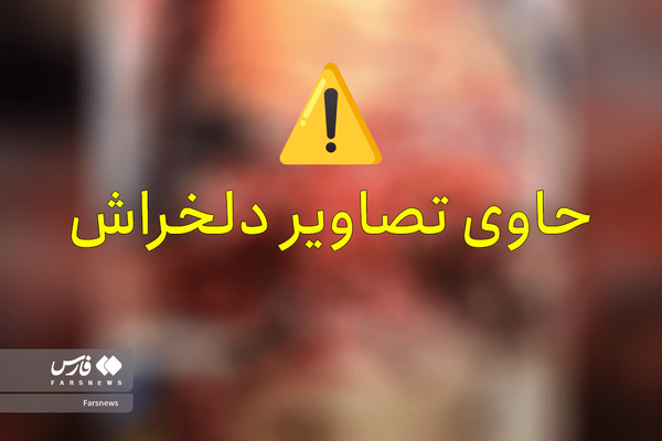 تصاویر دردناک