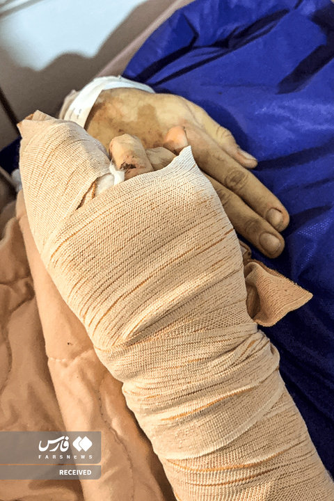 تصاویر دردناک