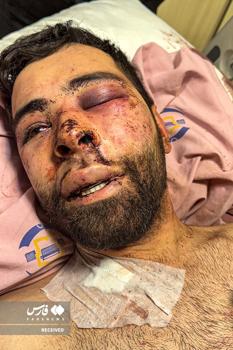 تصاویر دردناک