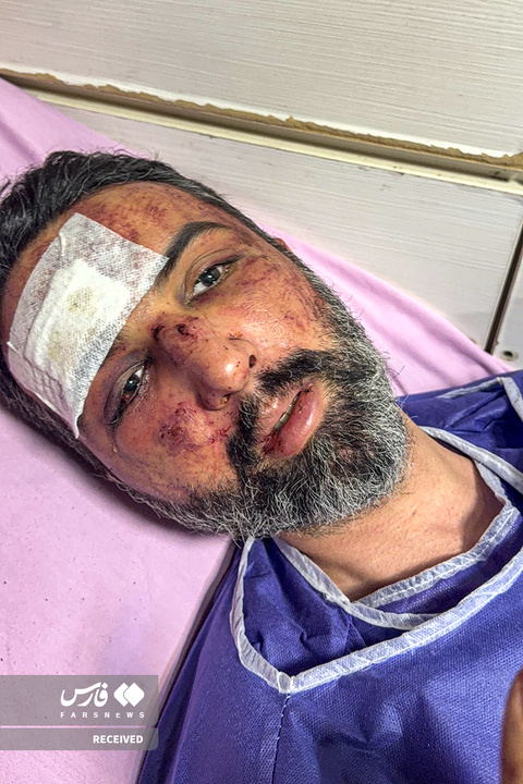 تصاویر دردناک