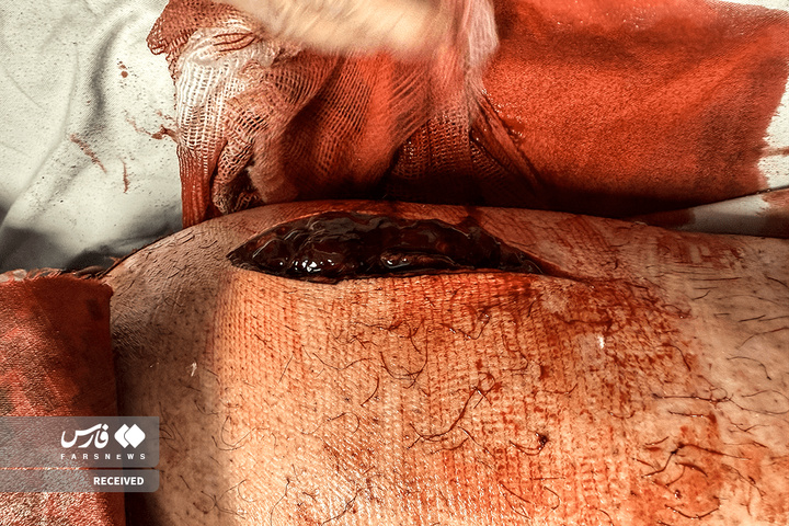 تصاویر دردناک