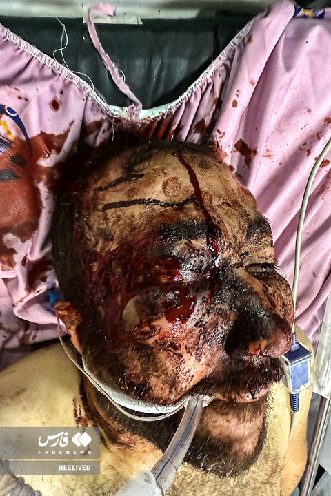 تصاویر دردناک