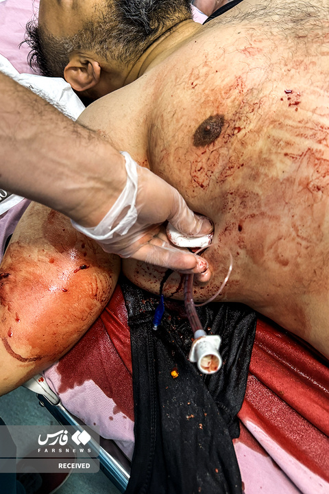 تصاویر دردناک