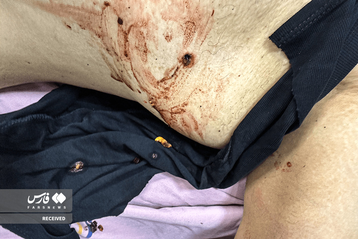 تصاویر دردناک