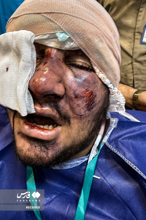 تصاویر دردناک