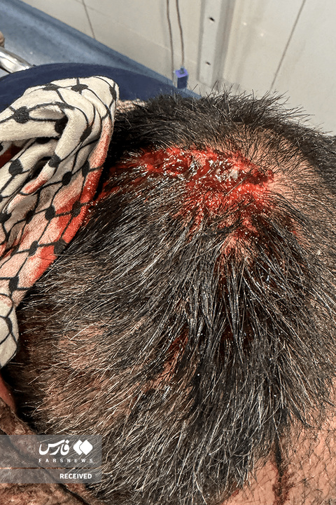 تصاویر دردناک