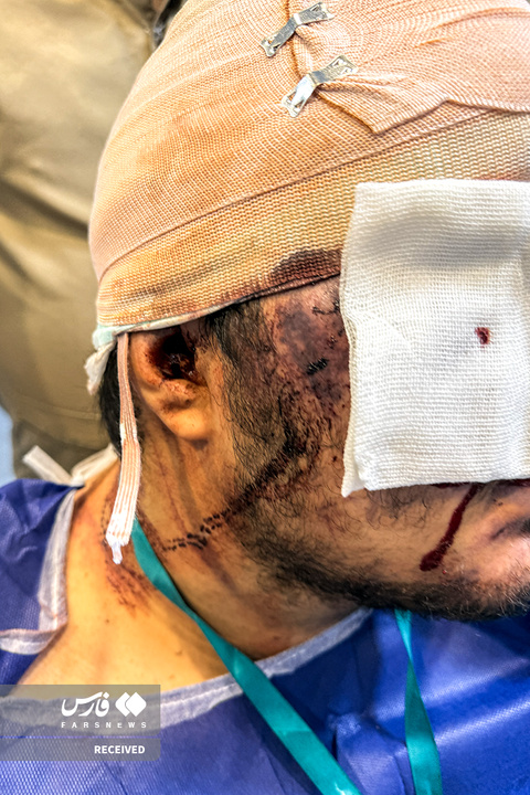 تصاویر دردناک