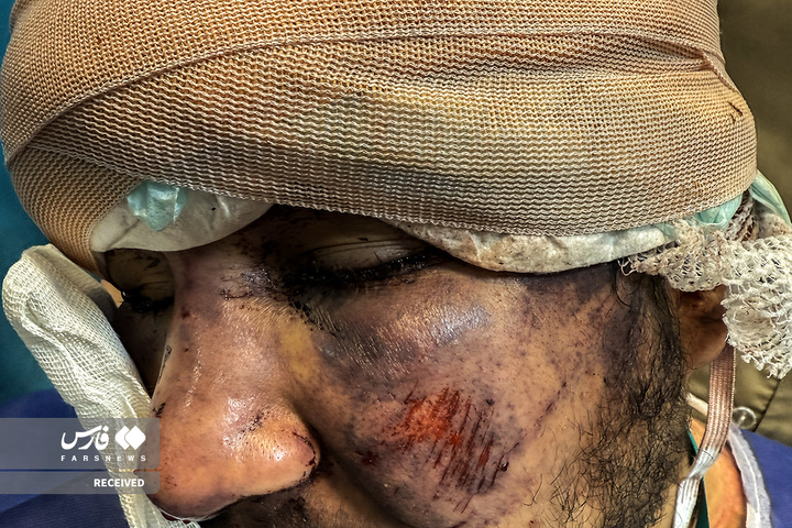 تصاویر دردناک