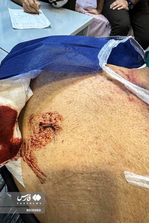 تصاویر دردناک