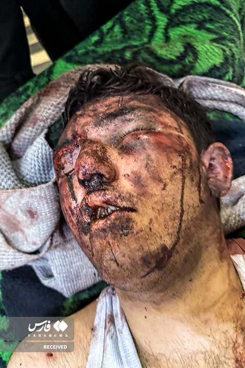 تصاویر دردناک