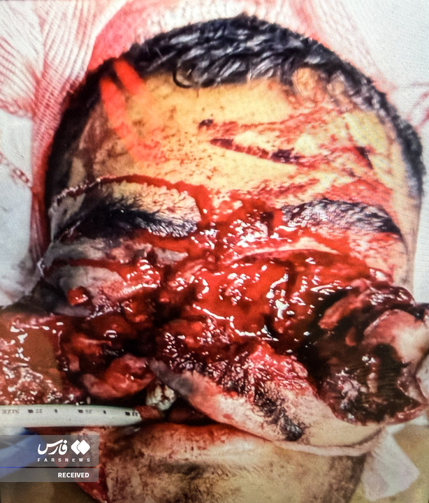 تصاویر دردناک