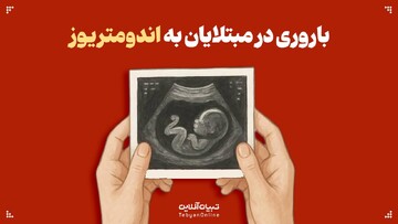 باروری در مبتلایان به اندومتریوز