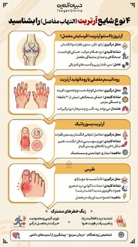 ۴ نوع شایع آرتریت را بشناسید