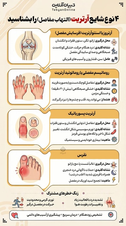 ۴ نوع شایع آرتریت را بشناسید