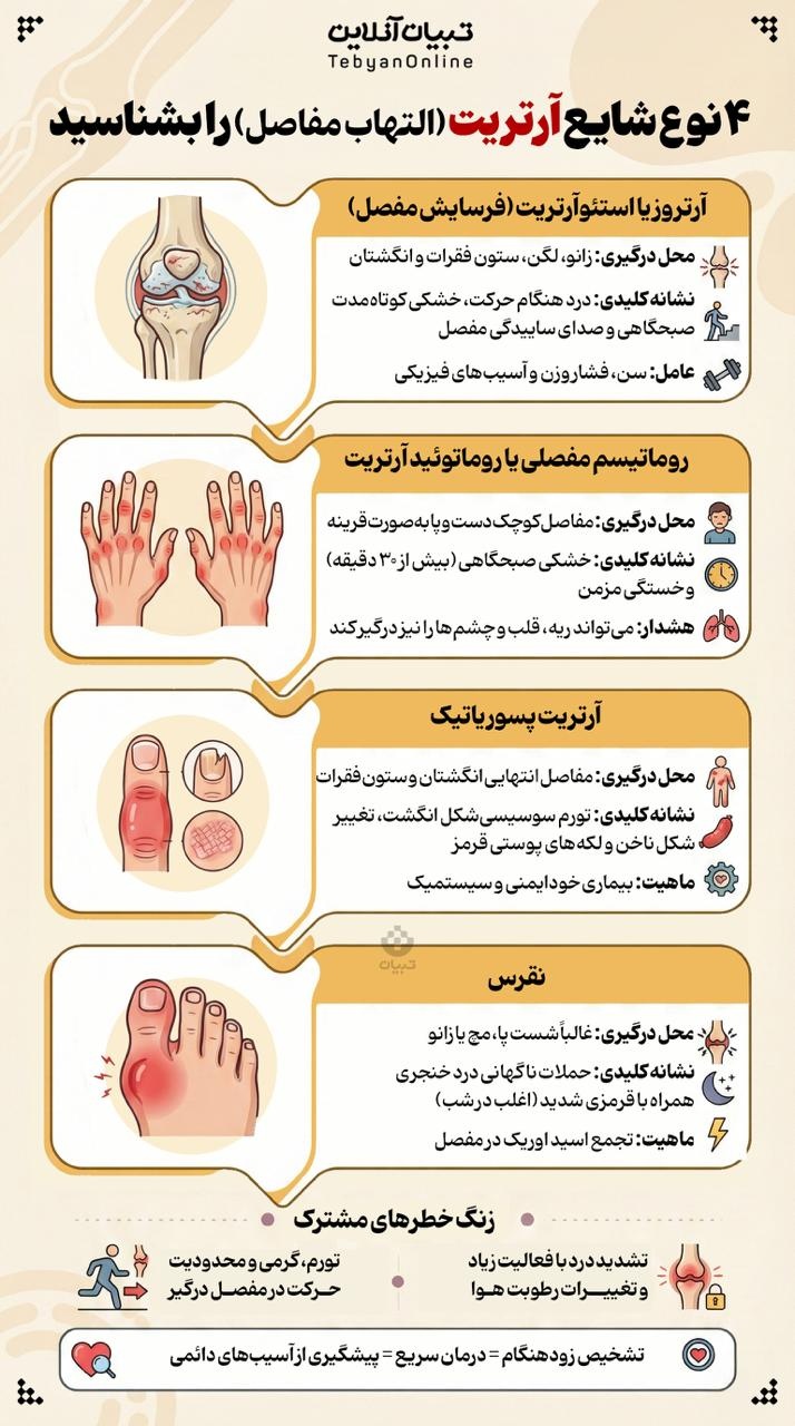 ۴ نوع شایع آرتریت را بشناسید