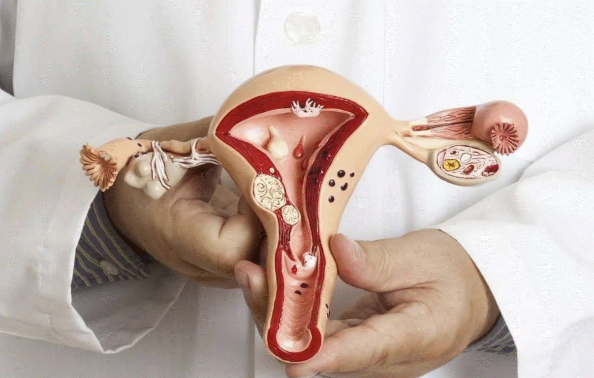 بهترین زمان برای سونوگرافی واژینال برای تخمک گذاری