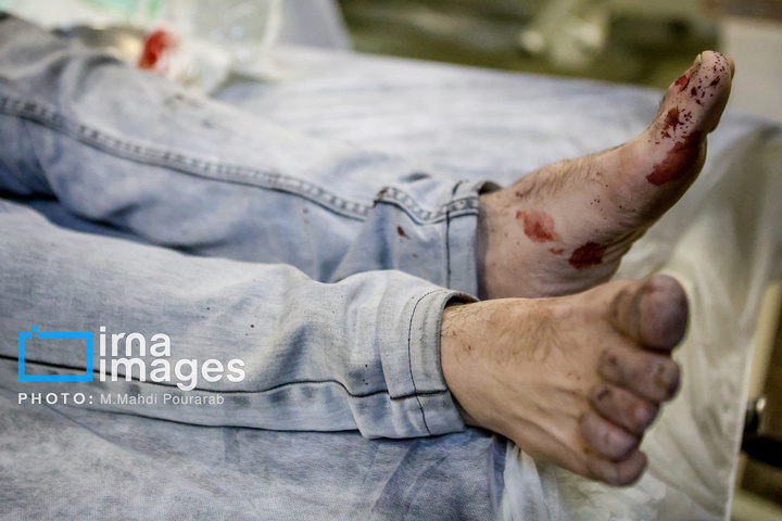 مجروحین حمله هوایی آمریکا و رژیم صهیونیستی به تهران
