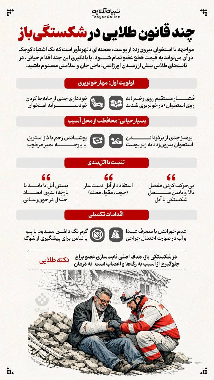 چند قانون طلایی در شکستگی‌باز