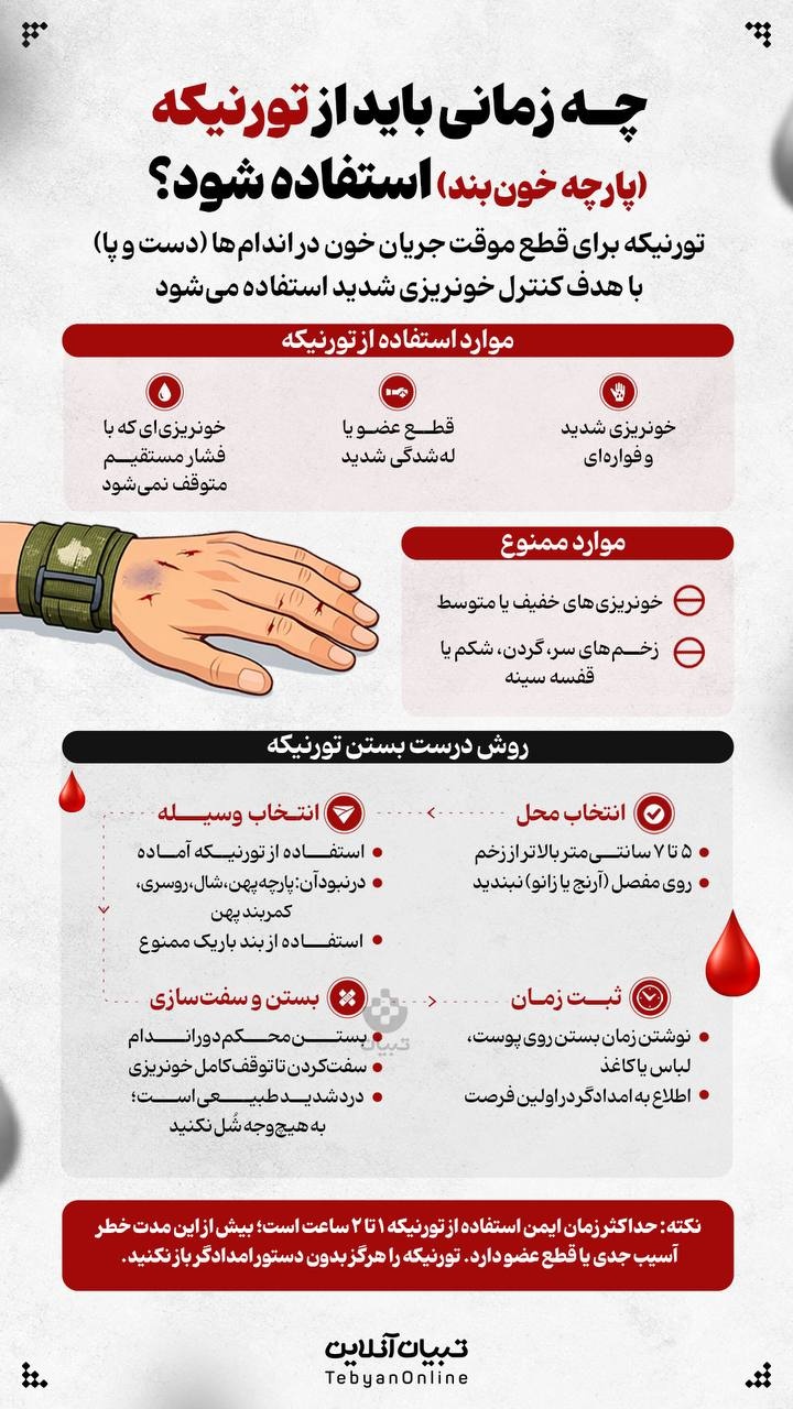 چه زمانی باید از تورنیکه (پارچه خونبند) استفاده شود؟ چه زمانی باید از تورنیکه (پارچه خونبند) استفاده شود؟