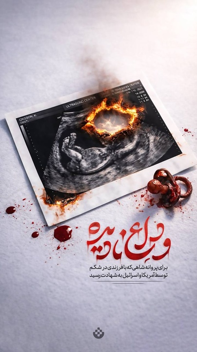 مرثیه‌ برای کودکی که هرگز زاده نشد