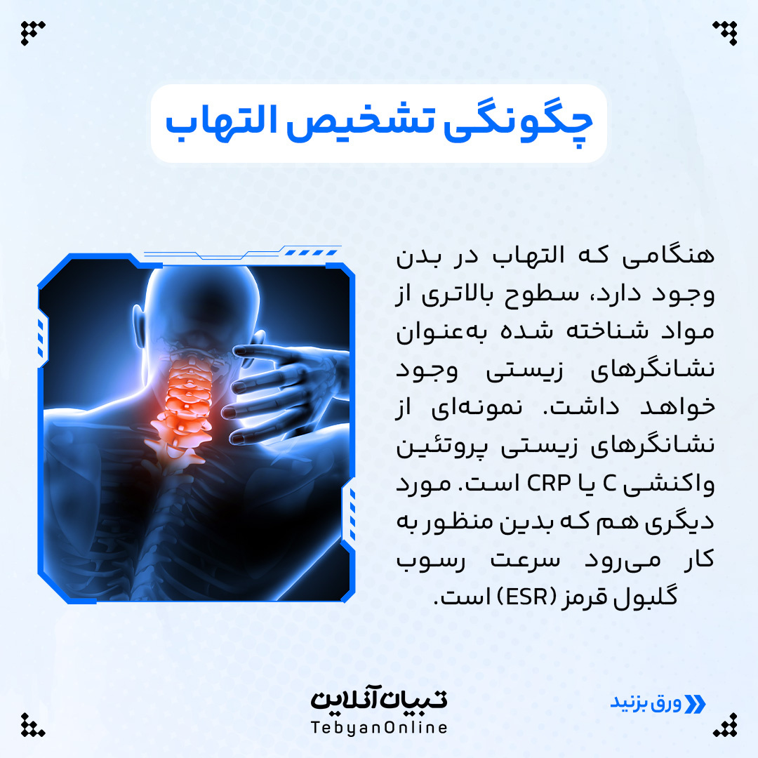 آنچه خوب است درمورد التهاب بدن بدانید