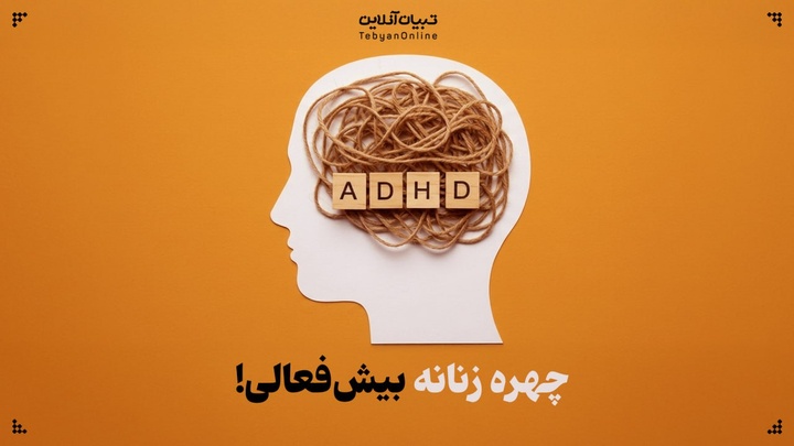 چهره زنانه بیش‌فعالی؛ طوفانی درونی پشت چهره‌ای آرام