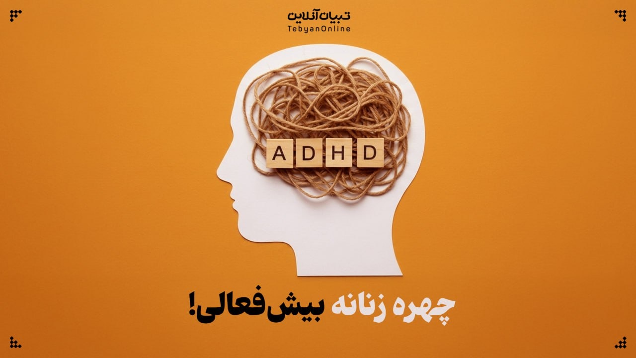 چهره زنانه بیش‌فعالی؛ طوفانی درونی پشت چهره‌ای آرام