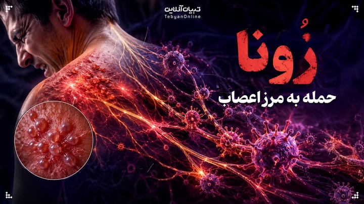 زونا؛ حمله به مرز اعصاب