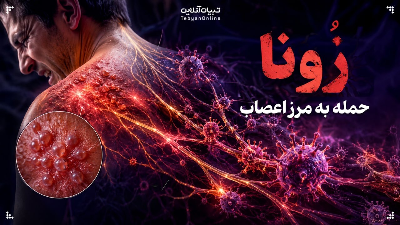 زونا؛ حمله به مرز اعصاب