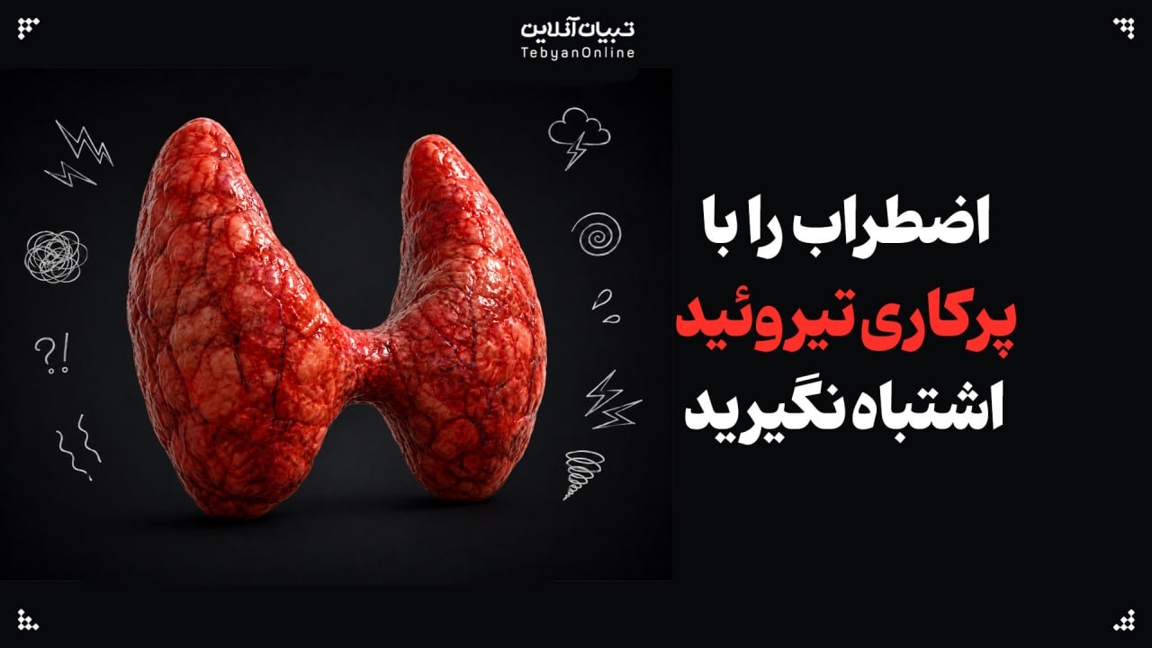 وقتی اضطراب با پرکاری تیروئید اشتباه گرفته میشود! وقتی اضطراب با پرکاری تیروئید اشتباه گرفته میشود!