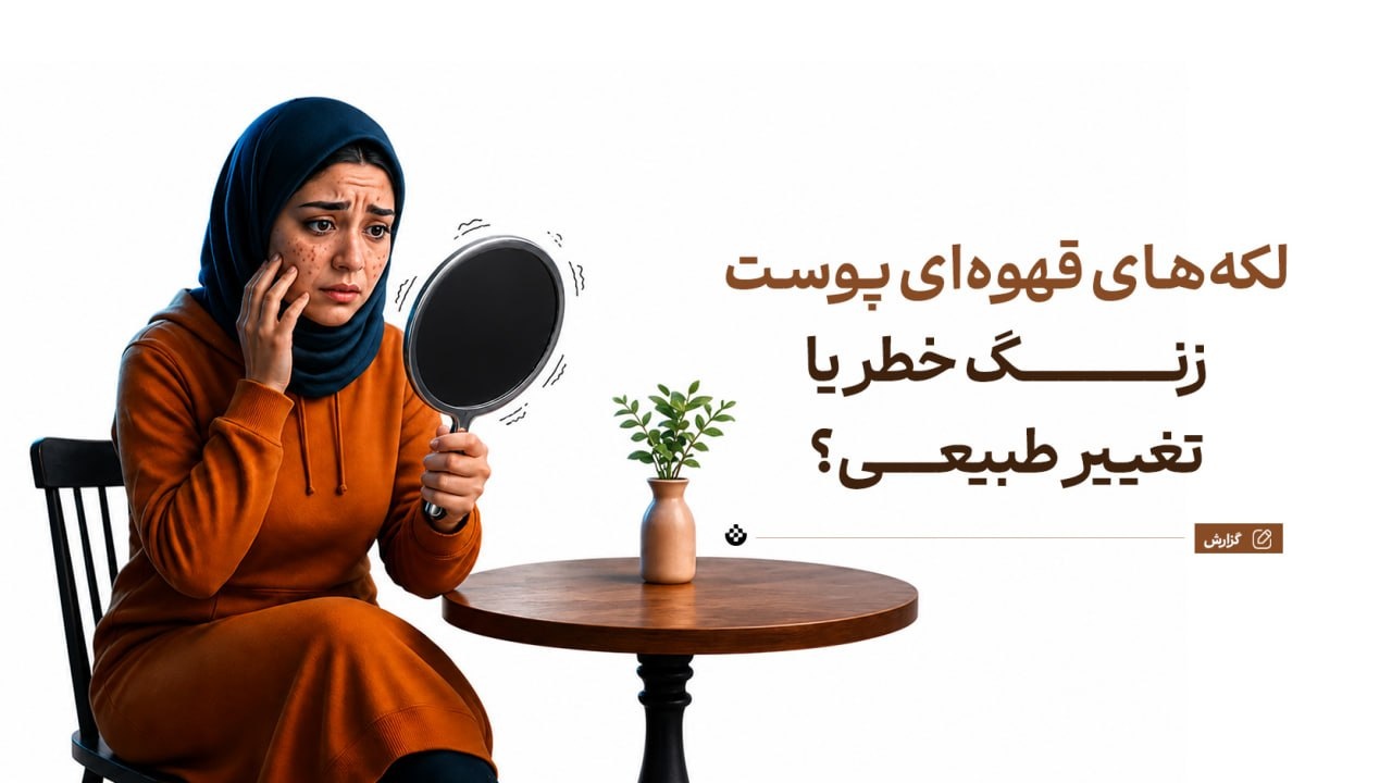 لکههای قهوهای پوست؛ زنگ خطر یا تغییر طبیعی؟ لکههای قهوهای پوست؛ زنگ خطر یا تغییر طبیعی؟