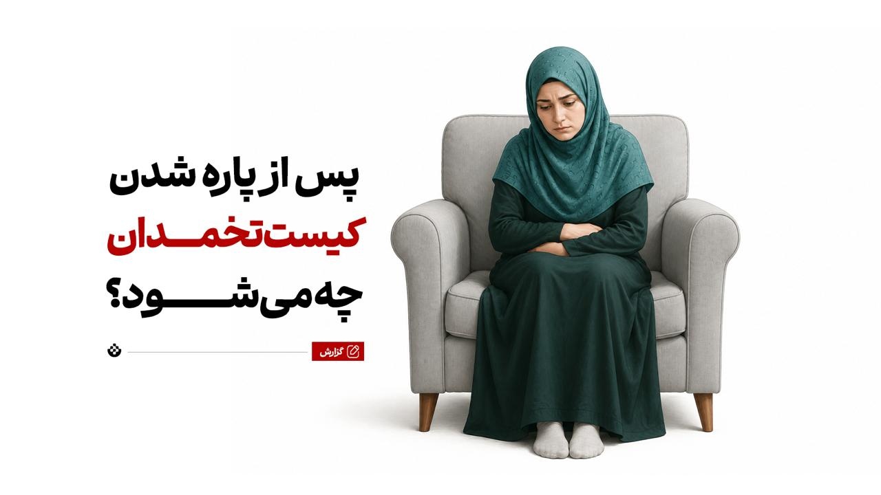 پس از پاره شدن کیست تخمدان چه میشود؟ پس از پاره شدن کیست تخمدان چه میشود؟