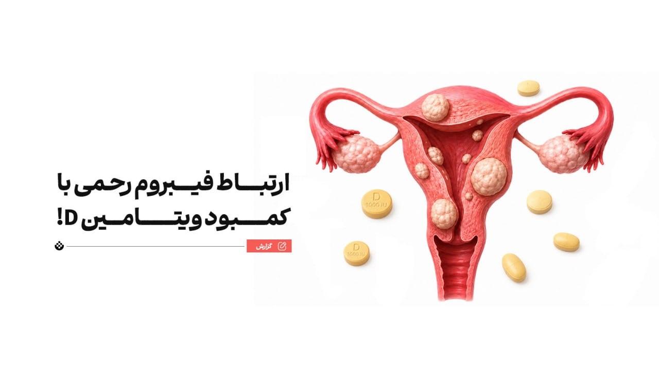 ارتباط فیبروم رحمی با کمبود یک ویتامین! ارتباط فیبروم رحمی با کمبود یک ویتامین!