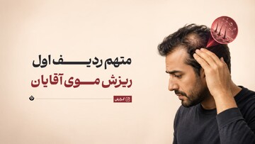 متهم ردیف اول ریزش موی آقایان