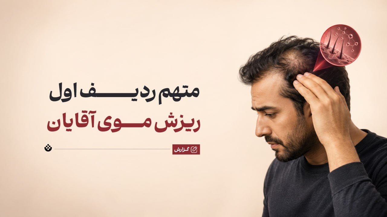 متهم ردیف اول ریزش موی آقایان متهم ردیف اول ریزش موی آقایان