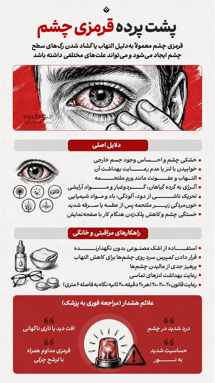 پشت پرده قرمزی چشم