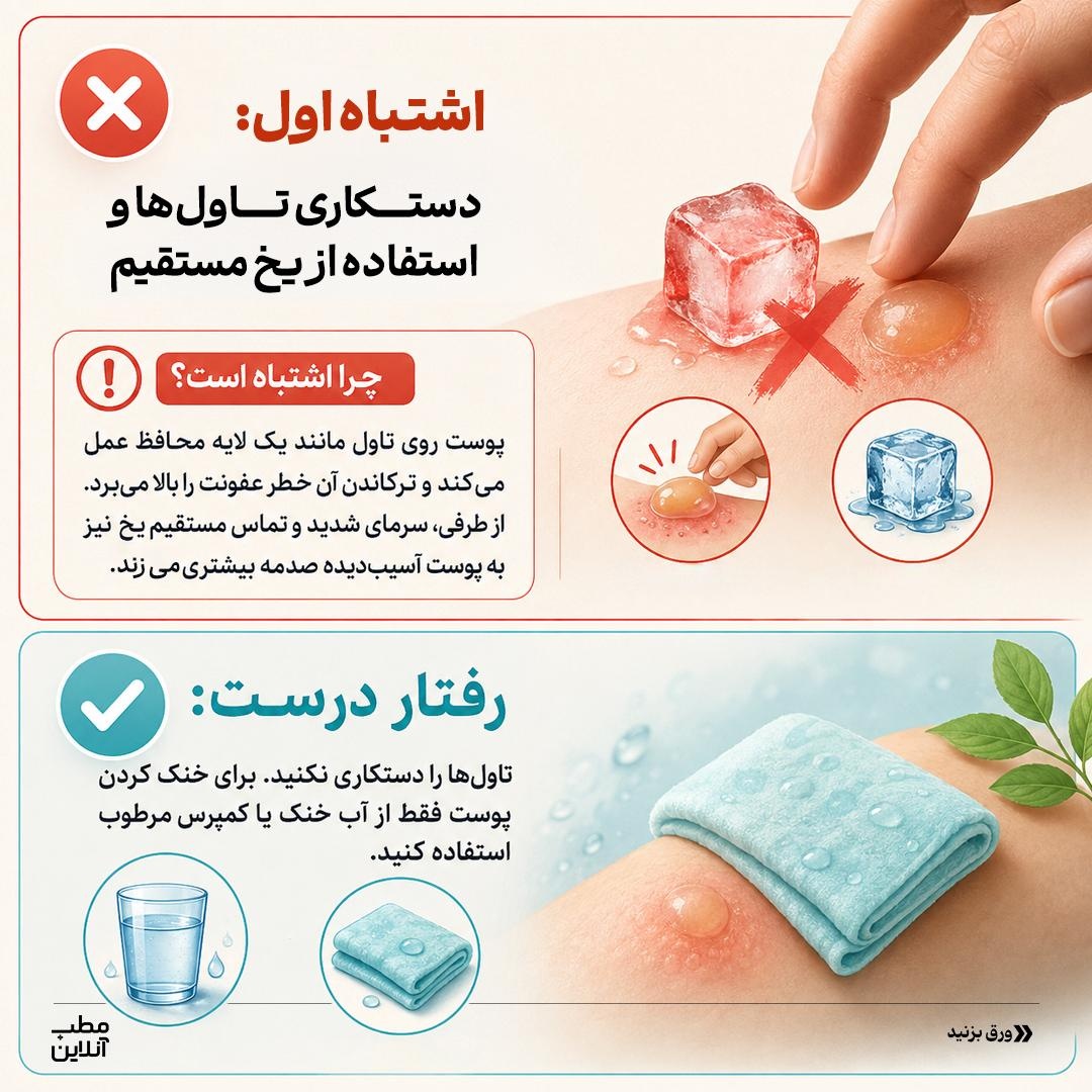 ممنوعه‌های آفتاب‌سوختگی!