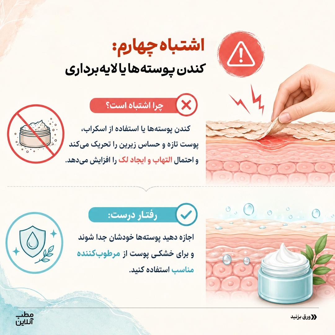 ممنوعههای آفتابسوختگی!