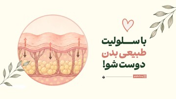 با سلولیت طبیعی بدن دوست شو!