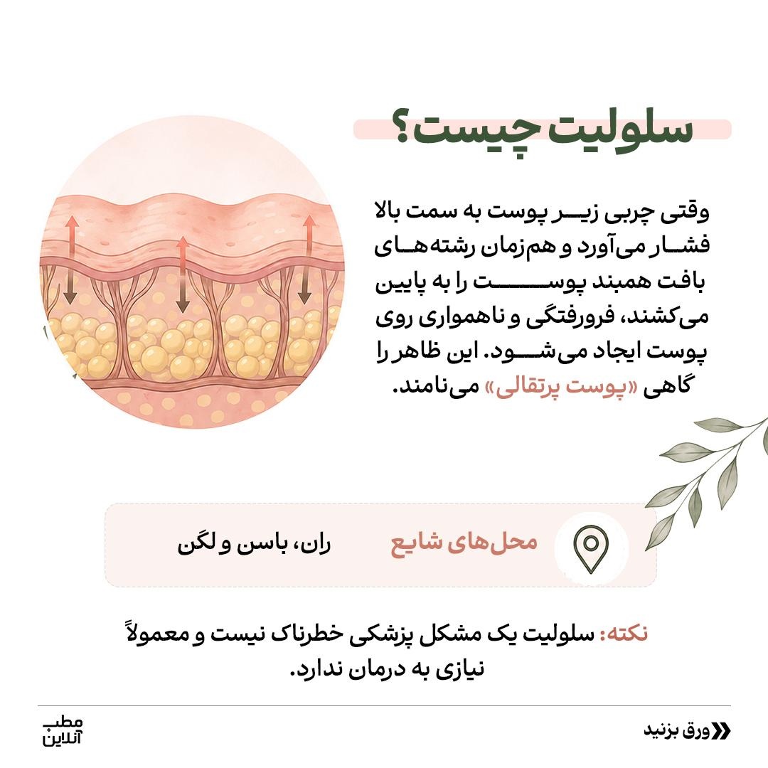 با سلولیت طبیعی بدن دوست شو!