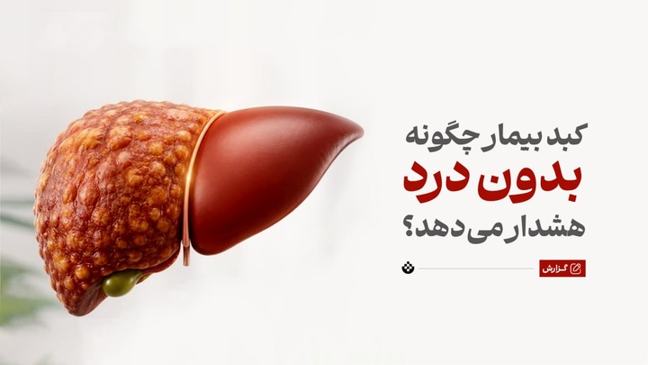 کبد بیمار چگونه بدون درد هشدار می‌دهد؟