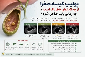پولیپ کیسه صفرا از چه اندازه‌ای خطرناک است؟ + زمان جراحی