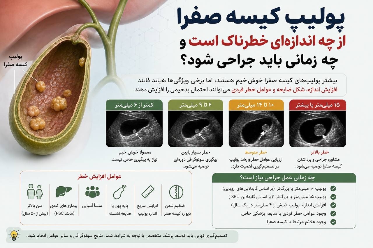 پولیپ کیسه صفرا از چه اندازه‌ای خطرناک است؟ + زمان جراحی